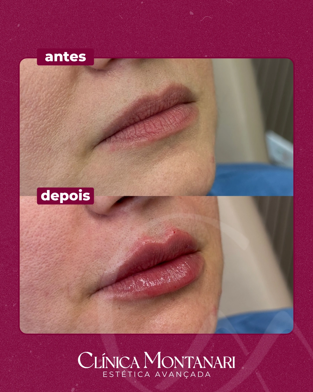 Resultado Clínica Montanari