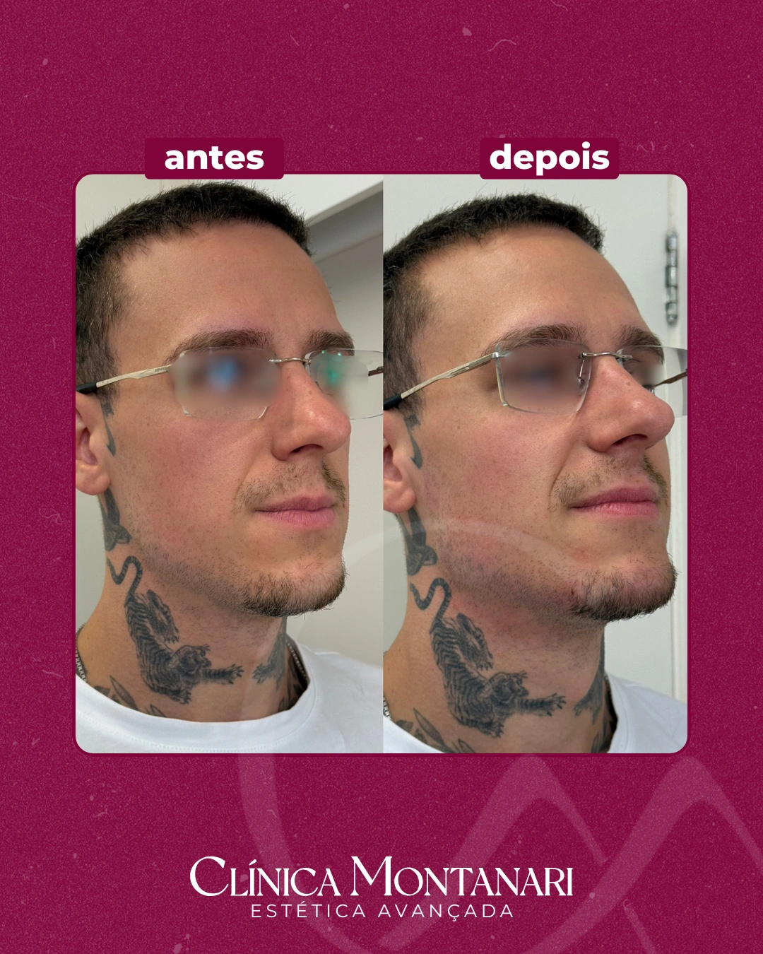 Resultado Clínica Montanari