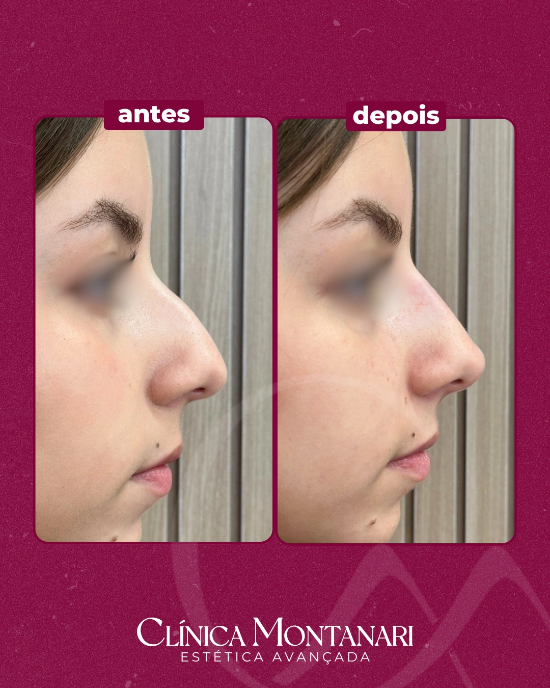 Resultado Clínica Montanari