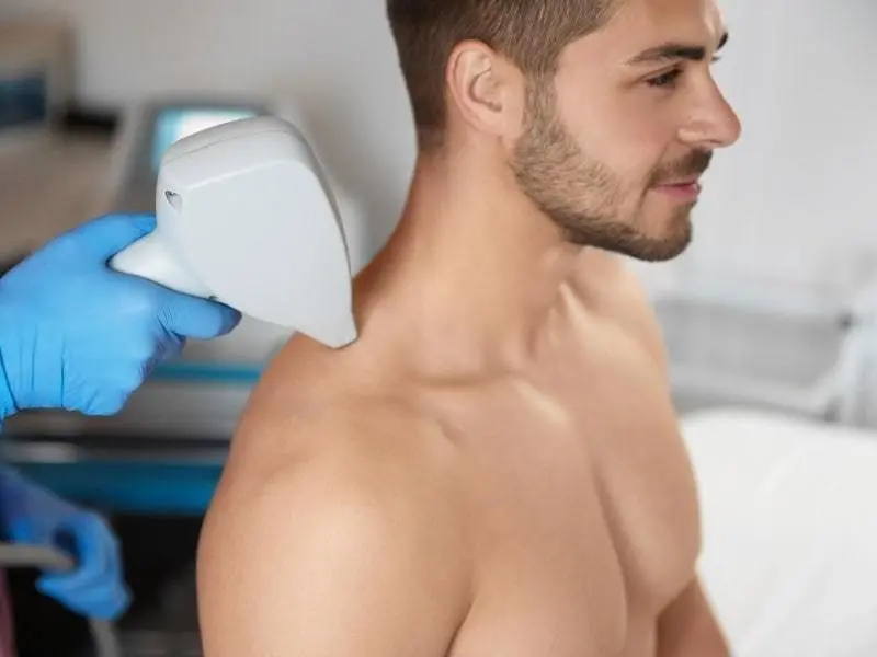 Depilação a Laser Masculina